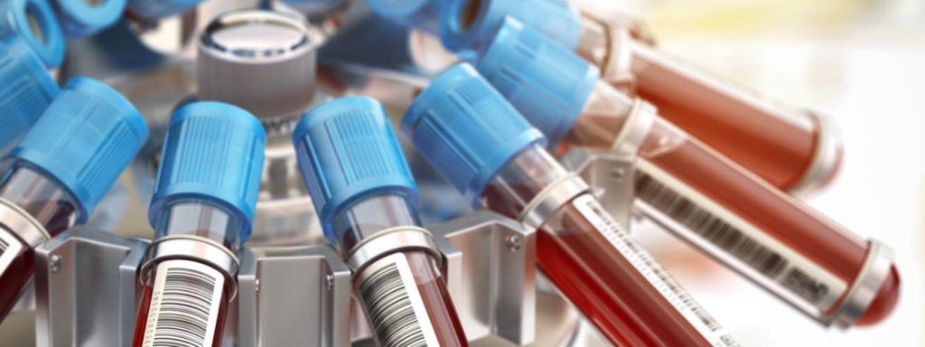 Worried About How to Book Your Diagnostic Tests? And the Cost?  Here is a Quick Guide to Make it&nbsp;Easy!