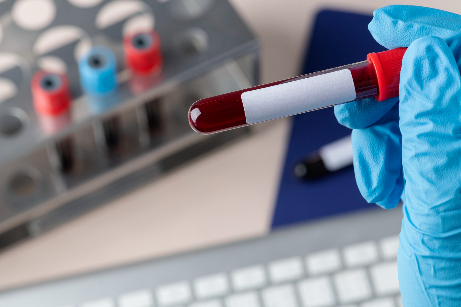 MMG Helps You Arrange Diagnostic Tests for Faster Treatment Abroad